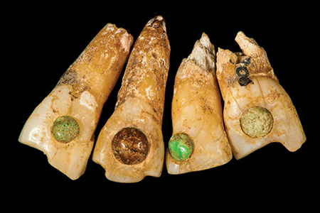 Teeth photo image